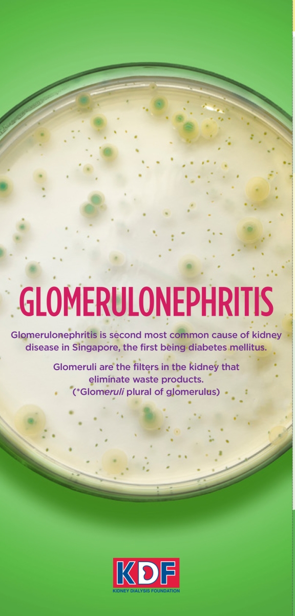 Glomerulonephritis