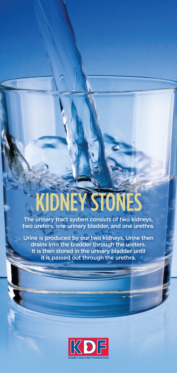 Kidney Stones