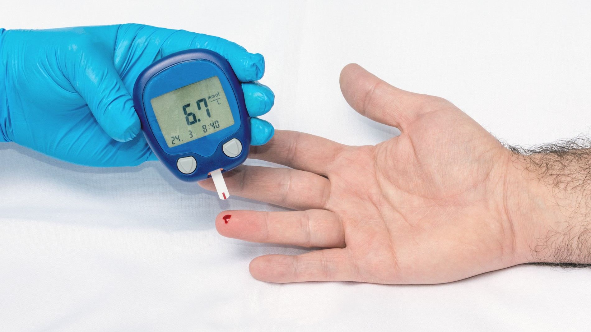 Diabetes and Kidney Disease in Singapore: Causes, Symptoms, and How to Slow Progression